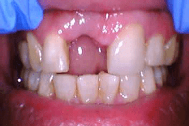before dental procedure image